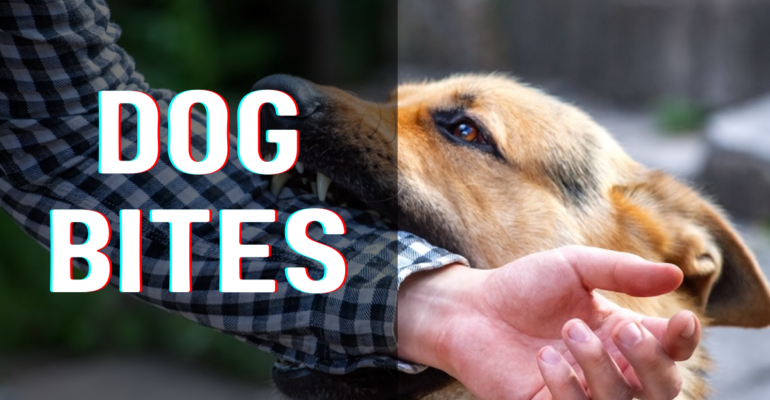 Dog Bites: How Big a Problem?